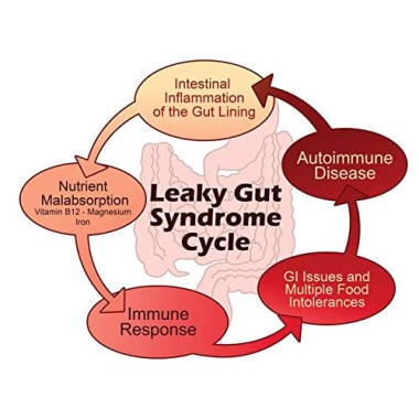 Livestus Laboratories Liposomal Colostrum Superior Bioavailability - B07MVZ3QSQ