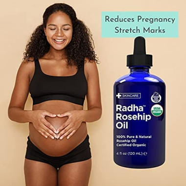 Radha Beauty Rosehip - B00LNOV8JO