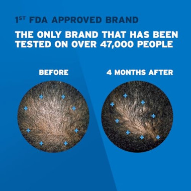 Rogaine Men's Rogaine 5% Minoxidil - B0012BNVE8